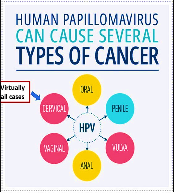 Human Papillomavirus Can Cause Several Types of Cancer