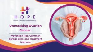 Read more about the article Unmasking Ovarian Cancer: Prevention Tips, Common Spread Sites, and Treatment Methods