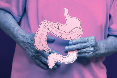Colorectal Cancer