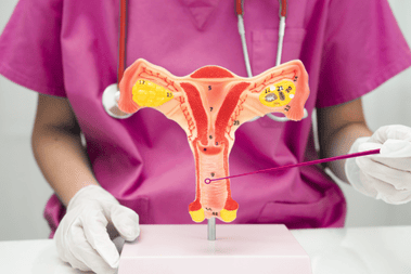 Cervical Cancer Treatment